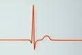 Electrocardiogram ECG displaying a junctional rhythm, 3D illustration