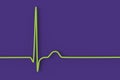 Electrocardiogram ECG displaying a junctional rhythm, 3D illustration