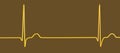Electrocardiogram ECG displaying a junctional rhythm, 3D illustration