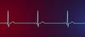 Electrocardiogram ECG displaying sinus bradycardia, 3D illustration