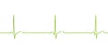 Electrocardiogram ECG displaying sinus bradycardia, 3D illustration