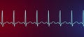 Electrocardiogram ECG displaying sinus tachycardia, 3D illustration