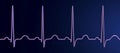 Electrocardiogram ECG displaying sinus tachycardia, 3D illustration