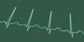 Electrocardiogram ECG displaying sinus tachycardia, 3D illustration