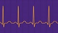 Electrocardiogram ECG displaying sinus tachycardia, 3D illustration