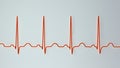 Electrocardiogram ECG displaying sinus tachycardia, 3D illustration