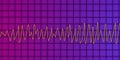 Electrocardiogram ECG displaying Torsades de pointes rhythm, 3D illustration