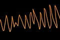 Electrocardiogram ECG displaying Torsades de pointes rhythm, 3D illustration