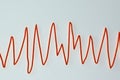 Electrocardiogram ECG displaying Torsades de pointes rhythm, 3D illustration