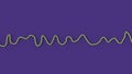 Electrocardiogram ECG displaying ventricular fibrillation rhythm, 3D illustration