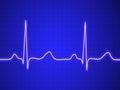 Electrocardiogram, ecg, graph, pulse tracing Royalty Free Stock Photo