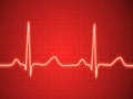Electrocardiogram, ecg, graph, pulse tracing Royalty Free Stock Photo