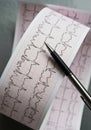 Electrocardiogram (ECG) printout featuring multiple waveforms on a grid paper, Royalty Free Stock Photo
