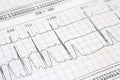 Electrocardiogram ekg heart Royalty Free Stock Photo