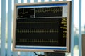 Electrocardiogram monitor