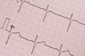 Electrocardiogram Printout Royalty Free Stock Photo