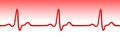 Electrocardiogram pulse graph