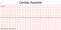 Electrocardiogram show Cardiac asystole pattern.