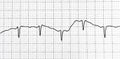 Electrocardiogram test that shows electrical activity of the heart