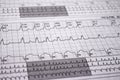 Electrocardiogram strips with cardiac arrhythmias. Alterations of heartbeats represented on paper. Selective focus on some beats.