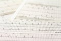 Electrocardiogram strips with cardiac arrhythmias. Selective focus on some beats. Free space to write