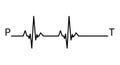 Electrocardiogram waveform showing p wave qrs complex and t wave in detail Royalty Free Stock Photo
