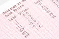 Electrocardiography Chart