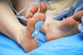 electrode from a muscle stimulator attached to the inner surface of a persons foot, demonstrating the use of Royalty Free Stock Photo