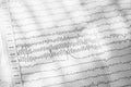 Electroencephalogram result on paper closeup, brain activity test