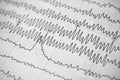 Electroencephalogram result on paper closeup, brain activity test