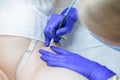 Electrolysis master working with a model in the armpit area removing unwanted hairs using an electrode and tweezers Royalty Free Stock Photo