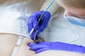 Electrolysis master working with a model in the armpit area removing unwanted hairs using an electrode and tweezers Royalty Free Stock Photo