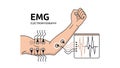 Electromyography EMG medical Royalty Free Stock Photo