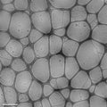 Electron image of nanoparticles made of lipids containing an anticancer drug (doxorubicin)