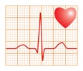 Electronic cardiogram ECG heart beat