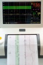 Electronic Cardiotocography Machine Monitoring Fetal Heart Contractions Of Uterus. Printing Cardiogram Report Coming Out