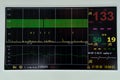 Electronic Cardiotocography Machine Monitoring Fetal Heart Contractions Of Uterus. Printing Cardiogram Report Coming Out