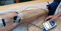 Electrostimulation of the quadriceps as a physiotherapy