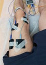 Electrostimulation of the quadriceps as a physiotherapy