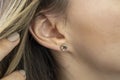 Elf& x27;s Ear. Close-up of a woman& x27;s ear with a fused lobe. Ear without earlobe.
