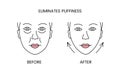 Eliminates puffiness, laser cosmetology before procedure and after applying treatment line icon in vector. Illustration