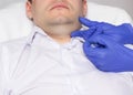 Elimination of the second chin in a young caucasian man with the help of cannoli. Introduction of special tightening threads