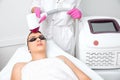 Elos epilation hair removal procedure on the face of a woman. Beautician doing laser rejuvenation on the forehead in a beauty Royalty Free Stock Photo