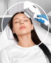 Elos epilation hair removal procedure on the face of a woman. Beautician doing laser rejuvenation on the forehead in a beauty Royalty Free Stock Photo