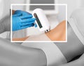 Elos epilation hair removal procedure on a womans body. Beautician doing laser rejuvenation in a beauty salon.