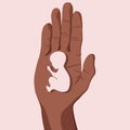 An embryo on the palm of a person. Miscarriage. Royalty Free Stock Photo