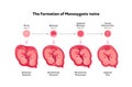 Embryo in womb medical diagram. Vector flat healthcare illustration. Formation of monozygotic twins. Design for health care, Royalty Free Stock Photo