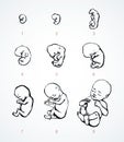 The development of the fetus of the child. Vector drawing