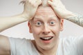 Emotional overjoyed surprised Albino male model with bugged eyes and open mouth. Royalty Free Stock Photo