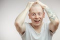 Emotional overjoyed surprised Albino male model with bugged eyes and open mouth.